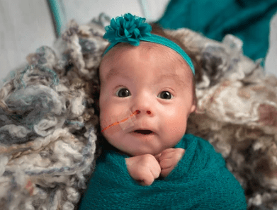 tube weaning
